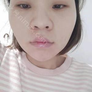 西安第四军医大学西京医院整形美容外科怎么样靠谱吗?附2022年较新价格表
