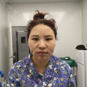 西安第四军医大学西京医院整形美容外科怎么样靠谱吗?附2022年较新价格表