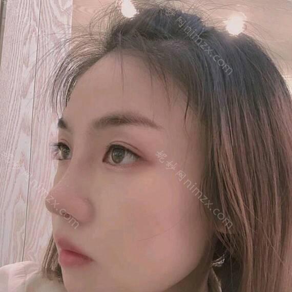 贵阳艺龄医疗美容是正规的不？隆鼻技术好不好，值不值得一去？