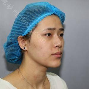 贵阳艺龄医疗美容医院怎么样是正规的整形医院吗？做皮肤护理价格贵吗