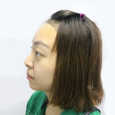 贵阳中医皮肤病医院可以做植发？植发技术好吗？现在能去做吗？