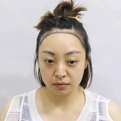 贵阳中医皮肤病医院可以做植发？植发技术好吗？现在能去做吗？