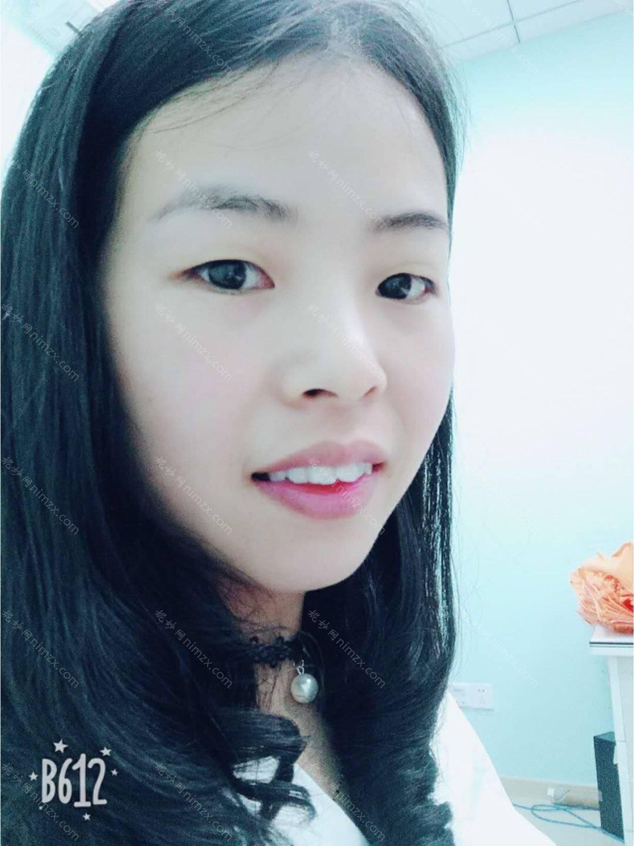 贵州京州口腔的牙齿矫正，我去做了，体验满满矫正效果也不错