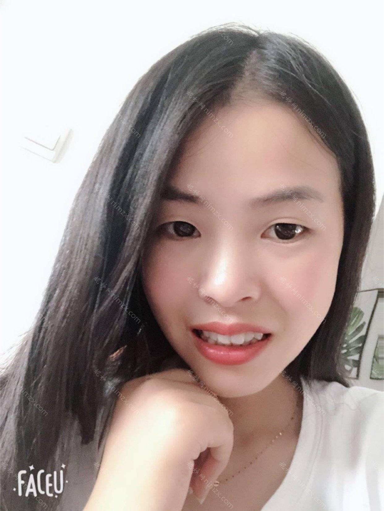 贵州京州口腔的牙齿矫正，我去做了，体验满满矫正效果也不错