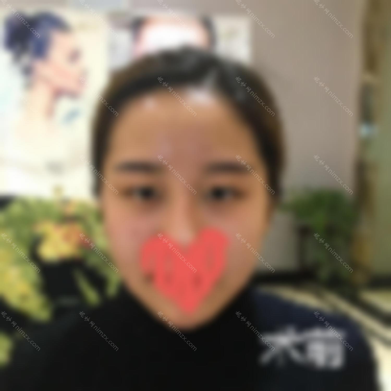 八大处尹琳双眼皮修复怎么样?简介擅长及案例展示