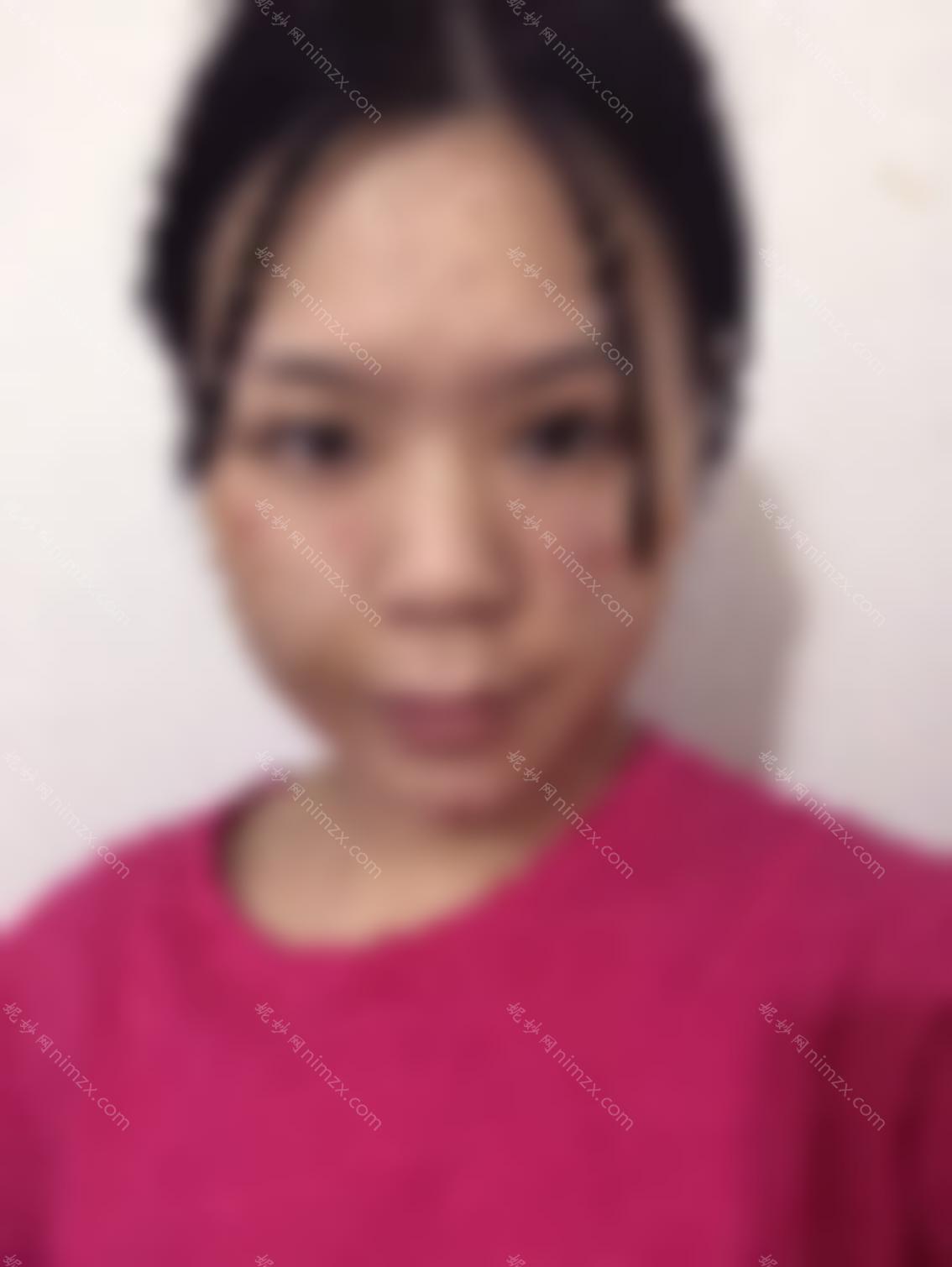 贵阳皮肤病专科医院是三甲医院吗？医院的项目做的好吗？
