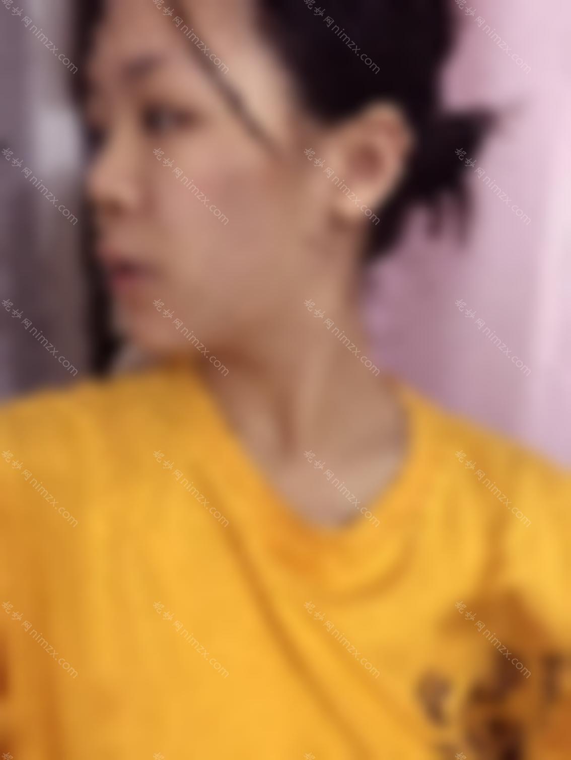 贵阳皮肤病专科医院是三甲医院吗？医院的项目做的好吗？