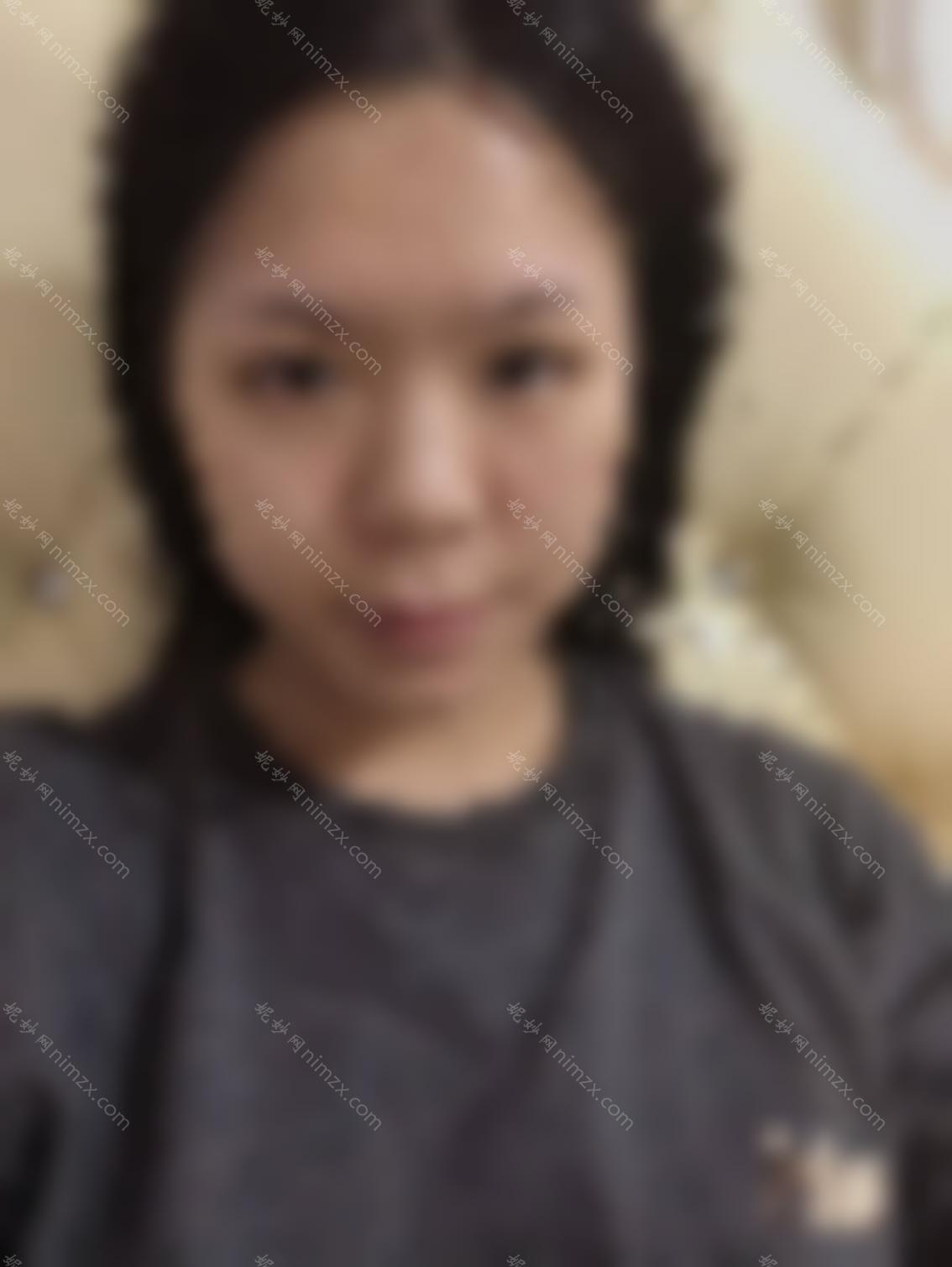 贵阳皮肤病专科医院是三甲医院吗？医院的项目做的好吗？
