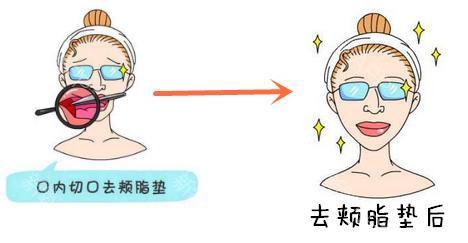 八大处宋维铭做埋线吗?案例收费
