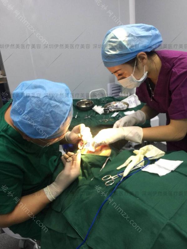 深圳伊然美医疗美容好不好？附上鼻部整形案例分享，重塑精致鼻型